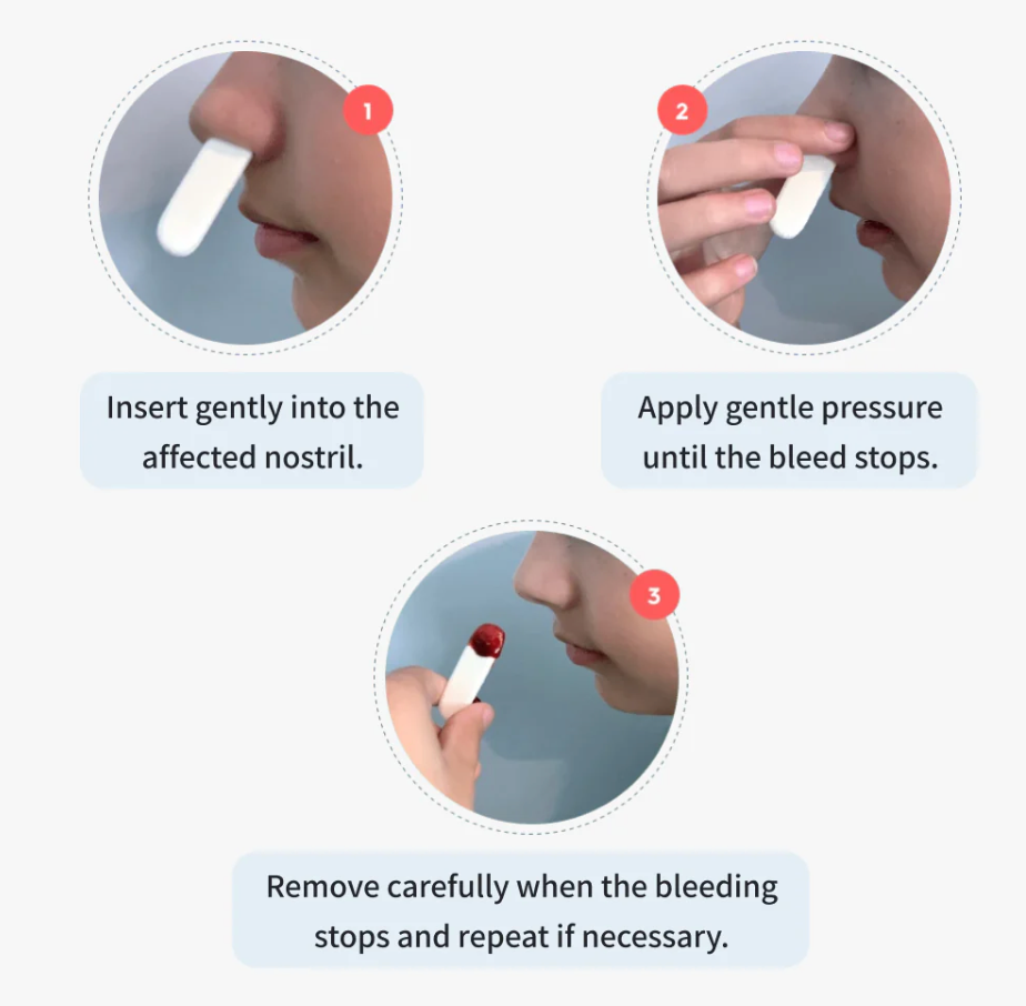 Nampons™ 12 Tapones Nasales Hipoalergénicos para Sangrado Nasal (Aprobado FDA) - Niño
