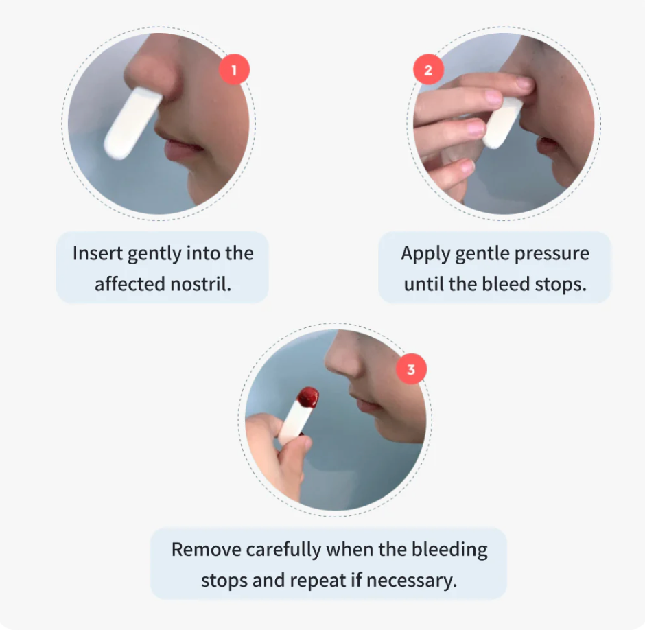 Nampons™ 12 Tapones Nasales Hipoalergénicos para Sangrado Nasal (Aprobado FDA) - Adulto