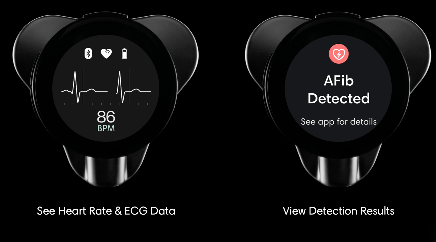 Estetoscopio Digital Eko CORE 500™ - McStethoscope