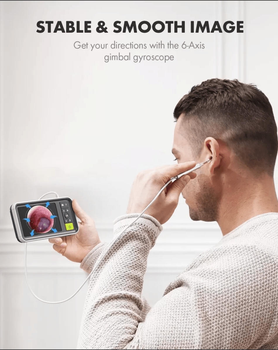 Otoscopio digital profesional con pantalla de 4.5 pulgadas para diagnósticos auditivos precisos.